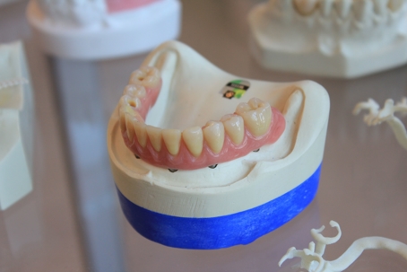 permanent denture